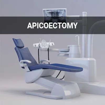 Visit our Apicoectomy page